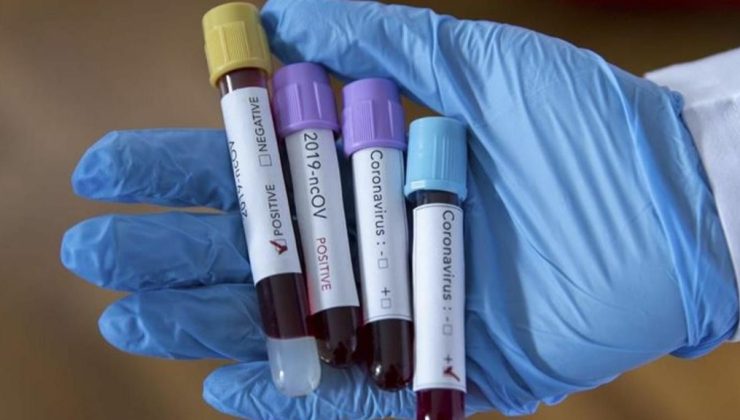 Son iki haftada 120 koronavirüs vakası tespit edildi