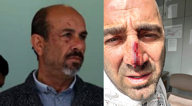 Pehlivan: Seni memleketten sürerim,  iznini iptal ederim
