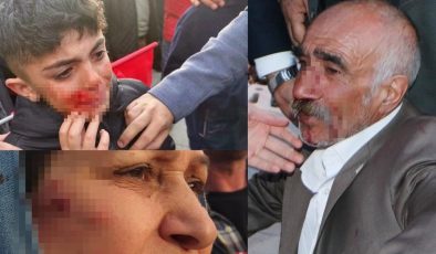 İmamoğlu’nun mitingine yönelik saldırıda yaralanan 17 kişi taburcu edildi