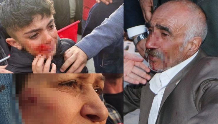 İmamoğlu’nun mitingine yönelik saldırıda yaralanan 17 kişi taburcu edildi
