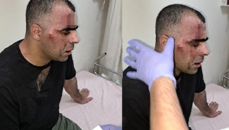 Gazeteci Sinan Aygül’e saldırı: 2 kişi tutuklandı