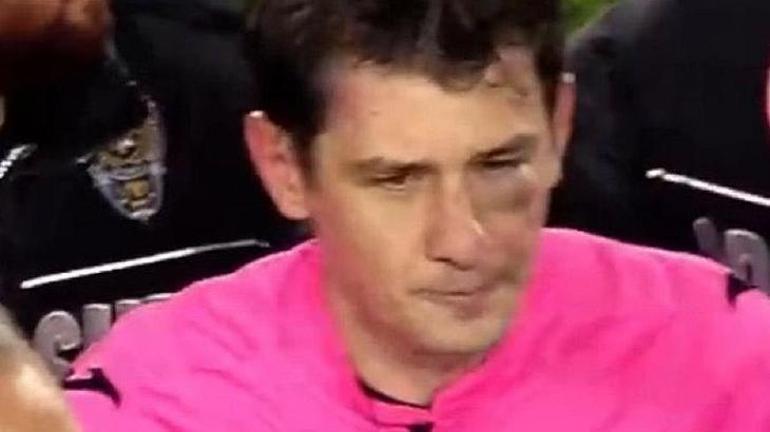 Son Dakika haberi: Hakem Halil Umut Melere yumruklu saldırı Sol gözü şişti, bir anda yerde kaldı Ankaragücü Başkanı Faruk Koca için soruşturma başlatıldı