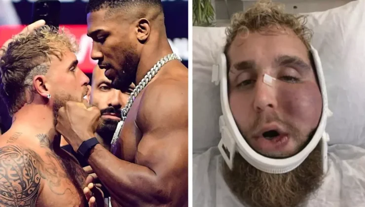 Suratı tanınmaz hale gelen Jake Paul’un ne kadar kazandığını duyunca şok olacaksınız