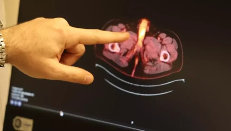 Tıp literatürüne giren son isim Diyarbakır’dan! Penisi alındı