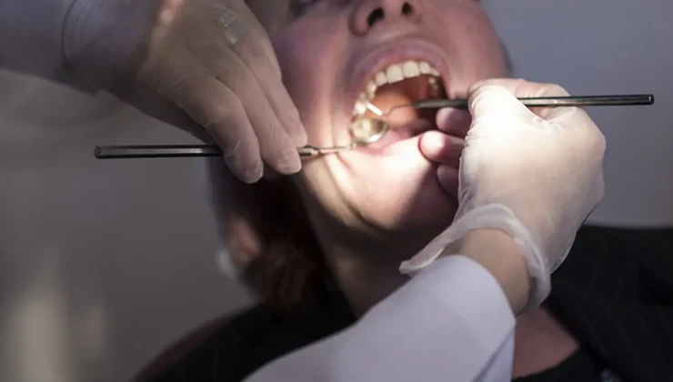 Uzman isim uyardı: Sağlam amalgam dolgulara dokunmayın!