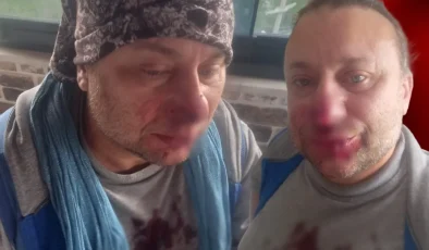 Pitbull saldırısına uğrayan Onur Akay yoğun bakımdan çıktı: Ölümden döndüm