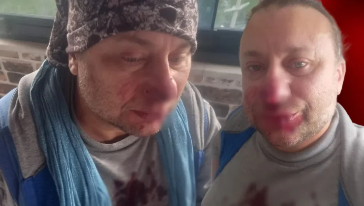 Pitbull saldırısına uğrayan Onur Akay yoğun bakımdan çıktı: Ölümden döndüm