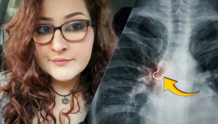 Köpek tüyü yuttuğunu sandı, gerçek röntgende ortaya çıktı! Meğer ciğerlerine saplanmış