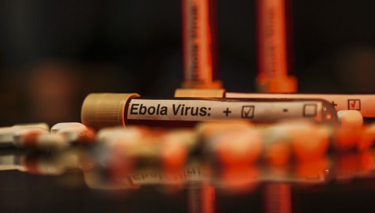 ABD’de 2026 FIFA Dünya Kupası öncesi bazı havalimanlarında Ebola tarama merkezleri kurulacak