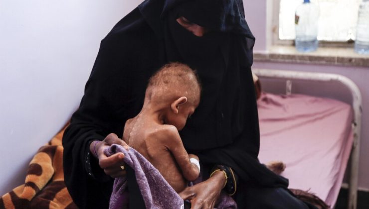 BM’den Yemen’de 18 milyondan fazla insanın şiddetli açlık çektiği uyarısı