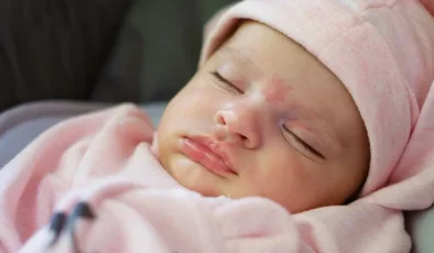 Doğum lekesinde tehlike sinyali! Masum görünüyor ama dikkat
