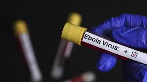 Rum makamları EBOLA’ya karşı uyarı durumunda