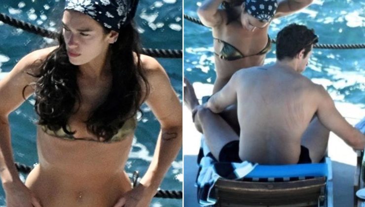 Dua Lipa’nın eşinin sırtındaki izler dikkat çekti
