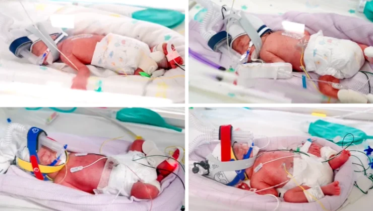 Avustralya’da bir kadın doğal yolla gebelik sonucu tek yumurta dördüzleri dünyaya getirdi
