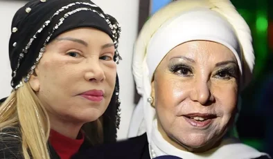 4 yıl önce yüz gerdirme operasyonu yaptırmıştı!