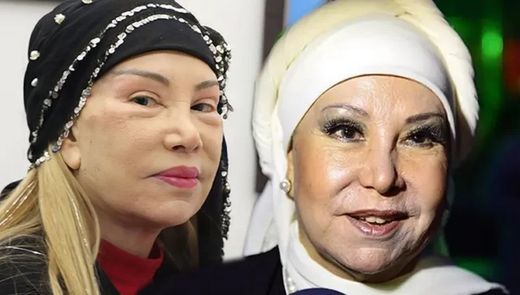 4 yıl önce yüz gerdirme operasyonu yaptırmıştı!