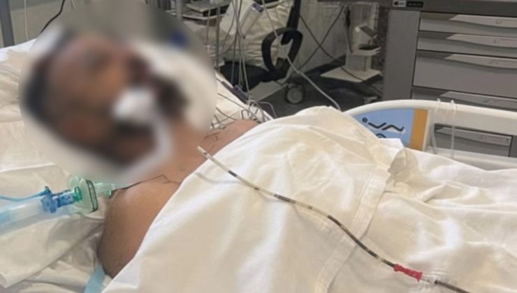 Ayia Napa’da KKTC vatandaşı 47 yaşındaki Ahmet Tan’ın darp edilmesiyle ilgili yürütülen soruşturmada yeni detaylar ortaya çıktı.