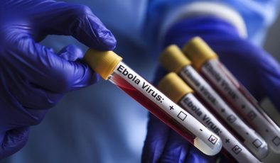 DSÖ Uganda’daki Ebola salgınının sona erdiğini doğruladı