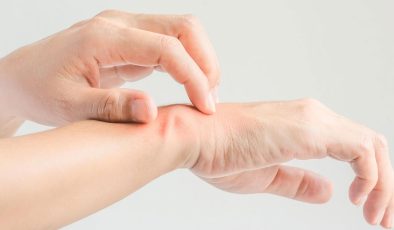Yaz sıcağında mantar alarmı!