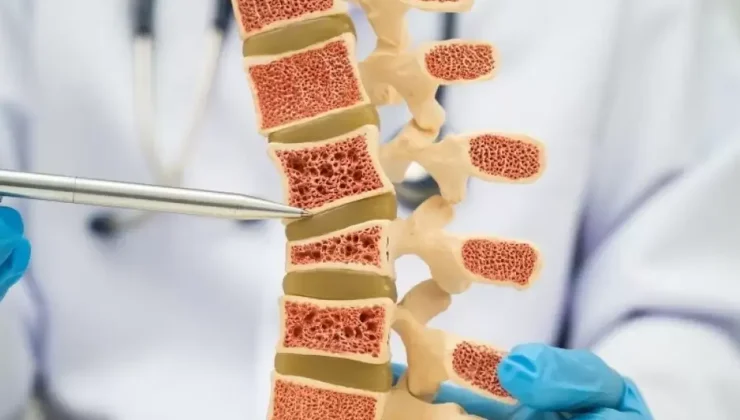 Uzman Dr. Tekin, osteoporozun kırığa kadar belirti vermeden ilerleyebildiğini söyledi